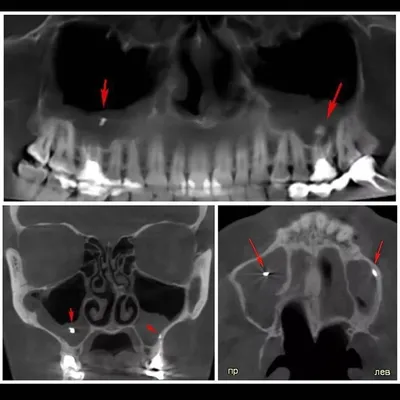 Голова KT : нормальная анатомия | e-Anatomy