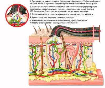 Лечение медицинскими пиявками в Костанае