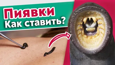 Гирудотерапия при остеохондрозе | Центр традиционной фито - и гирудотерапии  Е.И. Мингинович