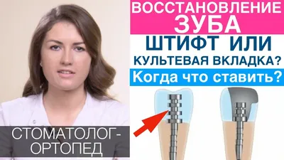 Культевая вкладка по доступным ценам|Стоматологическая клиника Vitasan