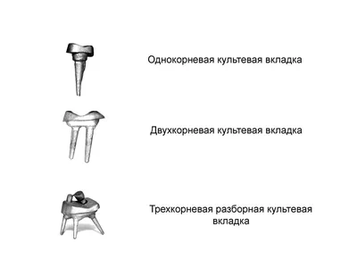 Культевая вкладка на зубы, стоимость культевой вкладки в стоматологической  клинике в Люблино