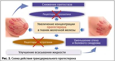 Лактостаз: тактические контраверсии — Extempore