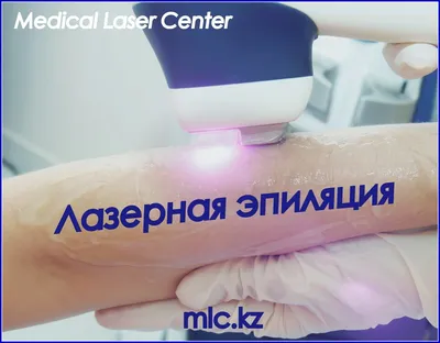 Лазерная эпиляция живота в Киеве (метро Театральная, Осокорки) - цены на лазерную  эпиляцию живота в центре LASER HEALTH