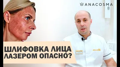 Лазерная шлифовка лица: нюансы до и после процедуры| Adonyss