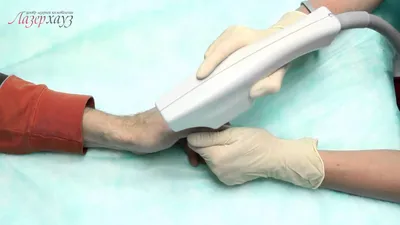Лечение грибка ногтей лазером,эффективные процедуры в Томске, цены