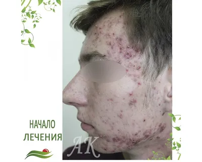 Наши работы (до/после) — ООО Медицинский центр \"МиРиТ\"