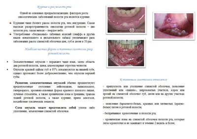 Фимоз - причины появления, симптомы заболевания, диагностика и способы  лечения