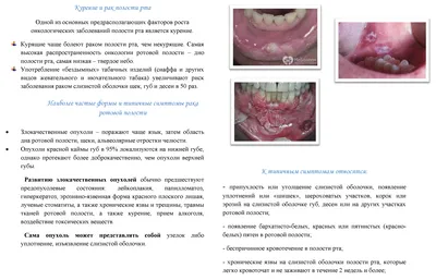 Воспаление слизистой оболочки полости рта, лечение