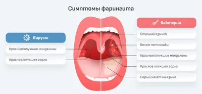 Морфолого- физиологическая характеристика лимфааденоидного глоточн