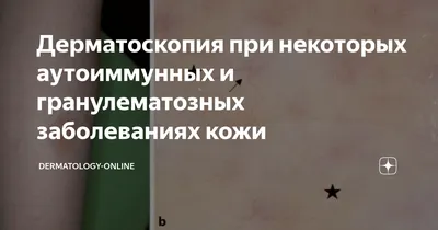 Демонстрация случая - Липоидный некробиоз | Дерматология в России