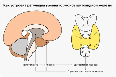 Гипотиреоз - MedTour