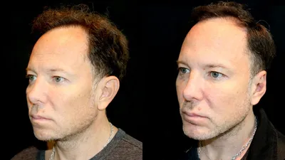 Фото до и после пластических операций в «СМ-Клиника»