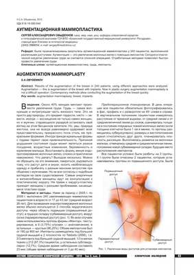увеличение груди - THS Turkish Health Service