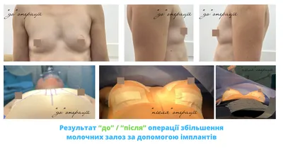 Маммопластика в Доминиканской Республике | Цена ▷ ТОП-10+ клиник 2024