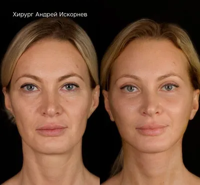 Ю.С.Васильев - Изменение формы лица: ортогнатическая и ортофациальная  хирургия