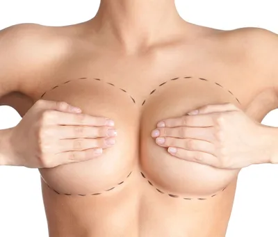 Подтяжка груди без операции - реальна ли? | Пластический хирург Осин Максим  Александрович
