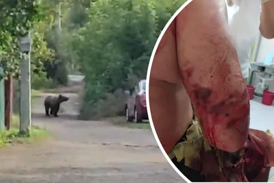 Медведь разорвал человека фотографии