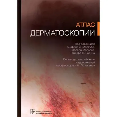 Дерматолог онлайн Анастасия Ляпцева on Instagram: \"Королева онкологии 👑...  Меланома ⠀ 🛑 В ленте - медицинский контент. Не листайте ленту, если не  хотите его видеть! ⠀ Меланома кожи - это злокачественная опухоль