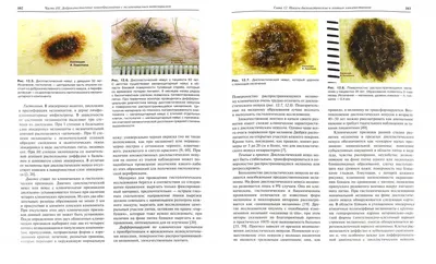 Инвазивная меланома кожи | MyPathologyReport.ca