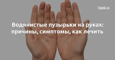 Водянистые пузырьки на руках: причины, симптомы, как лечить | 7Дней.ru