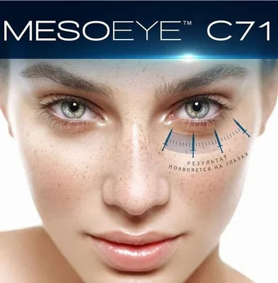 Mesoeye (Мезоай) C71 - Ваш взгляд в будущее