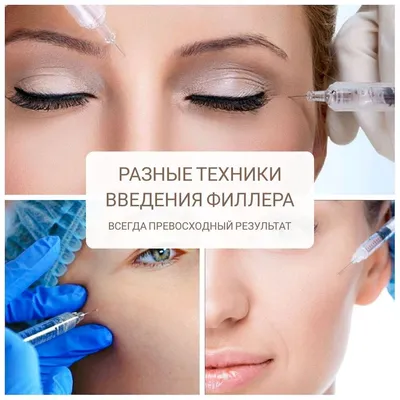 Мезотерапия препаратом MesoEye (1 мл): зона вокруг глаз в AvenueMedSpa