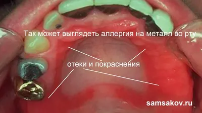 Жидкий металл перемешали пульсирующим электромагнитным полем - Индикатор