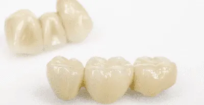 Зубные коронки: виды и описания | Клиника Колибри