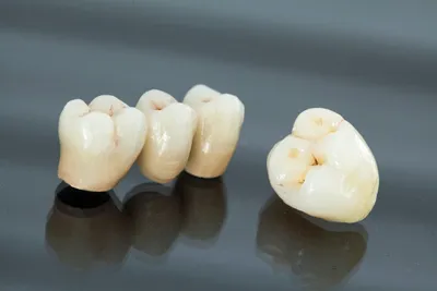 Коронки на зуб из циркония в Сочи - зубные коронки металлокерамика в  стоматологии \"Скаковский\"