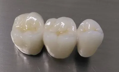 Коронки для фронтальных и боковых зубов