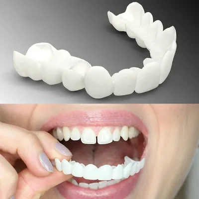 Металлокерамические коронки на зубы по низким ценам в СПБ - ProЗубы