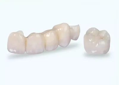 Установка циркониевых коронок в стоматологии | АктивСтом