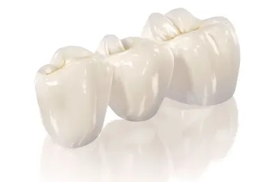 Коронка на зуб | Цены на зубные коронки в Ростове-на-Дону в стоматологии  Чернявского