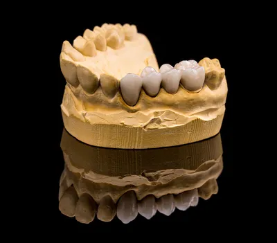 Коронки на зубы в Королёве — своя зуботехническая лаборатория