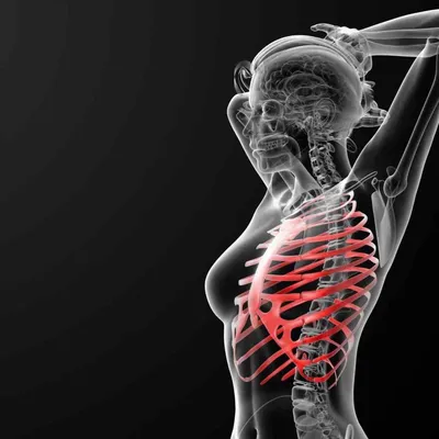 Лечение межреберной невралгии спины - диагностика, прогноз, как снять  приступ, методы лечения