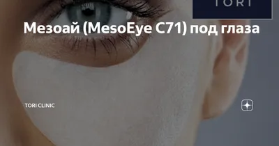 Уколы «Мезоай» вокруг глаз – описание процедуры, состав препарата, отзывы  об инъекциях | Косметология и эстетическая медицина | Дзен