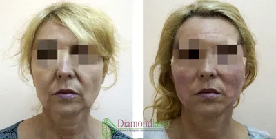 Мезонити – Lux Medicus