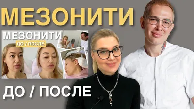МЕЗОНИТИ ДО и ПОСЛЕ спустя 9 месяцев #мезонити #подтяжкалица - YouTube
