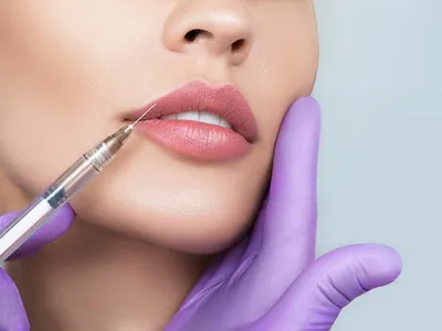Увеличение губ | Цены процедуры | Telos Beauty