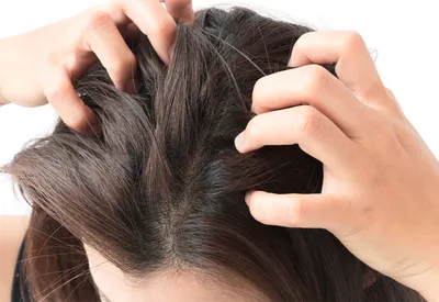 Что такое грибок волос и как лучше от него избавиться | Клиника Меди Лайф
