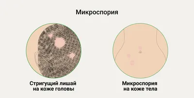 Диагностика волос и кожи головы: БЕСПЛАТНО в Москве - Клиника «Доктор Волос»