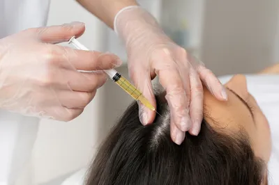 Заболевания кожи и волосистой части головы (Микроспория) | Горноуральская  районная поликлиника | Версия для слабовидящих