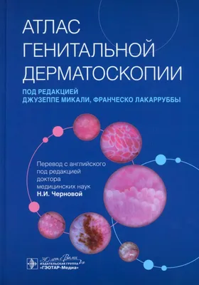 Качественное удаление кондилом в Минске, цена - Клиника в Уручье