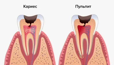 Удаление молочных зубов - за каждый клык для кошек и котов | SQ-lap