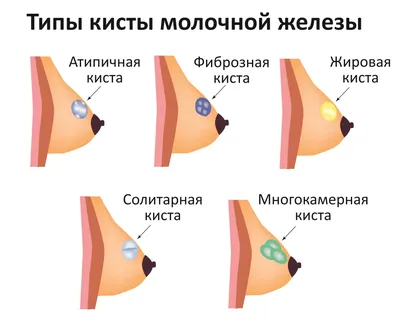 Плотность молочных желёз — Клиника Ланцетъ