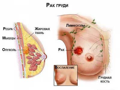 Молочная железа (анатомия)