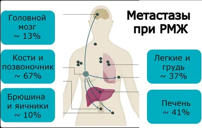 УЗИ молочных желез - прием в Медцентре Яхина Набережные Челны