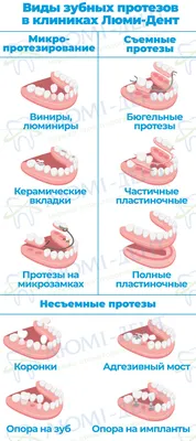 Зубной мост на жевательные зубы, цены в стоматологии