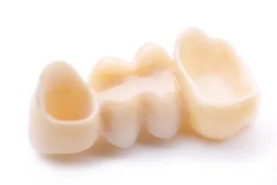Циркониевые коронки: цена в Москве на установку зубных коронок из диоксида  циркония в стоматологической клинике