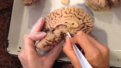 Головной мозг человека 3D модель - Скачать Анатомия на 3DModels.org